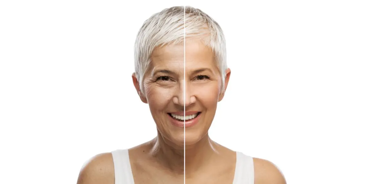 Botox Myths Debunked: Separating Fact from Fiction