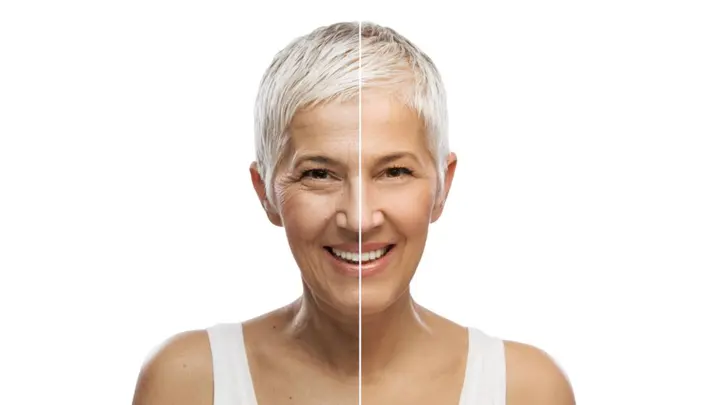 Botox Myths Debunked: Separating Fact from Fiction